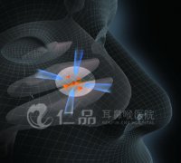 ������LTPM����