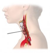 ʲô�����Լ�״�ٽ��