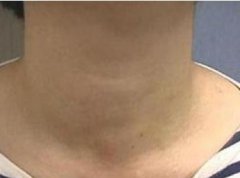 ����Լ�״���ױ���������