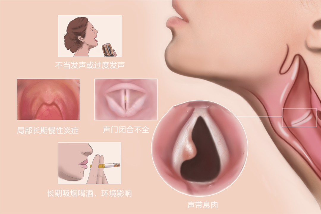 ܾ˻ơƣСϢ⣡
