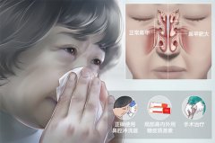 �Ǽ׷ʴ�ĵ���֢״����Щ��һ��˵���