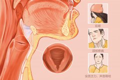 �Ͼ����Ǻ�ר��ҽԺ_����С�Ἰ�ֳ��������Ʒ���